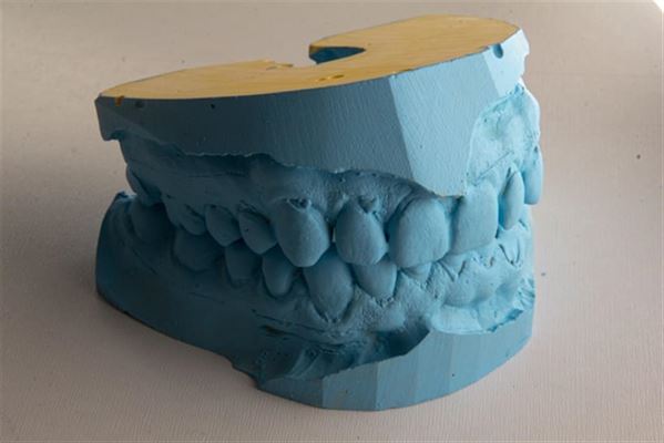 Snyd skæve tænder med smil og stil